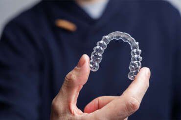 ¿Cómo sé si necesito ortodoncia o alineadores o brackets invisibles?