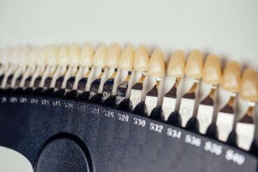 Blanqueamiento dental