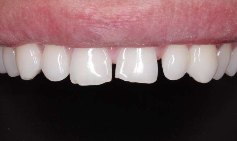 Diseño Sonrisa