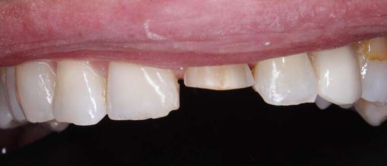 Diseño Sonrisa