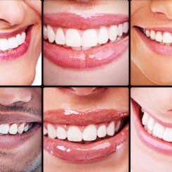Dentalika: Especialistas en Odontología Correctiva para una Sonrisa Funcional y Saludable