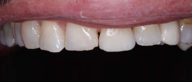 Diseño Sonrisa